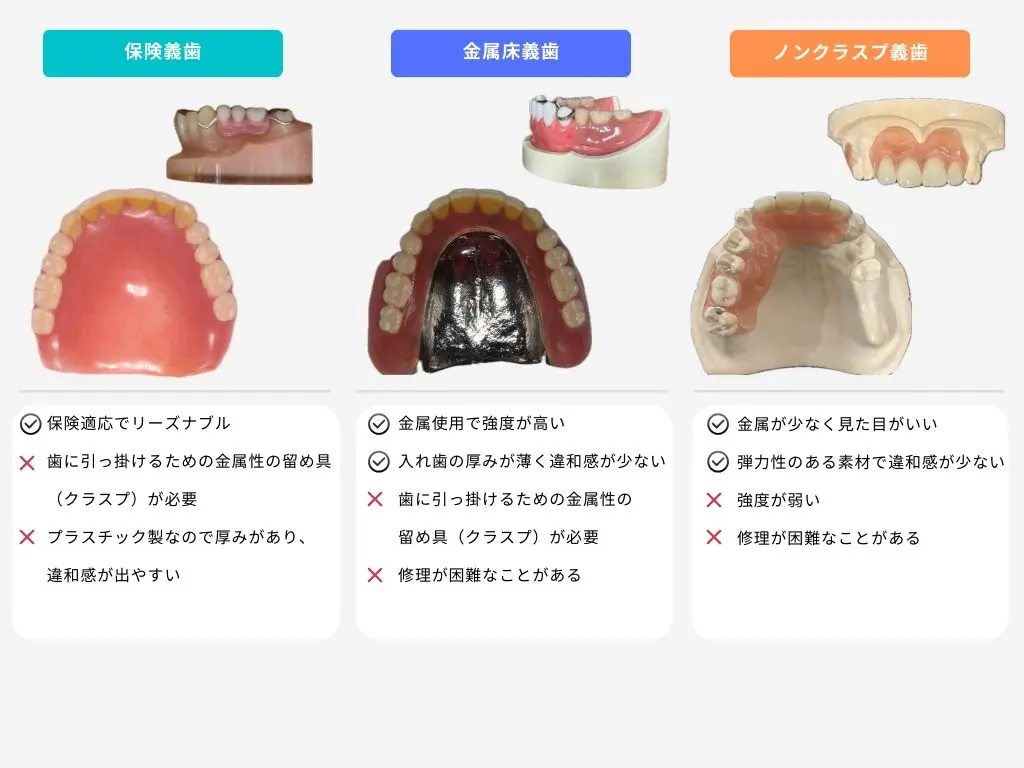 義歯　見本　総義歯 入れ歯 全部床義歯 歯科 ばんばんざい義歯 入れ歯（総義歯・部分義歯）｜検見川浜の歯医者｜上野歯科医院